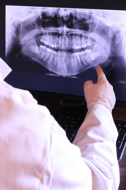Best Emergency Root Canal Treatment in Benson, UT